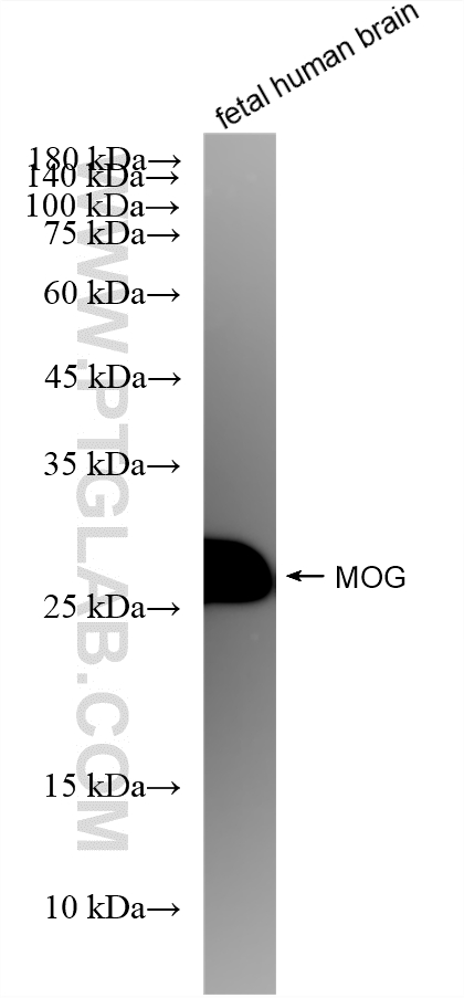 WB analysis of fetal human brain using 83063-6-RR (same clone as 83063-6-PBS) WB analysis of fetal human brain using 83063-6-RR (same clone as 83063-6-PBS)