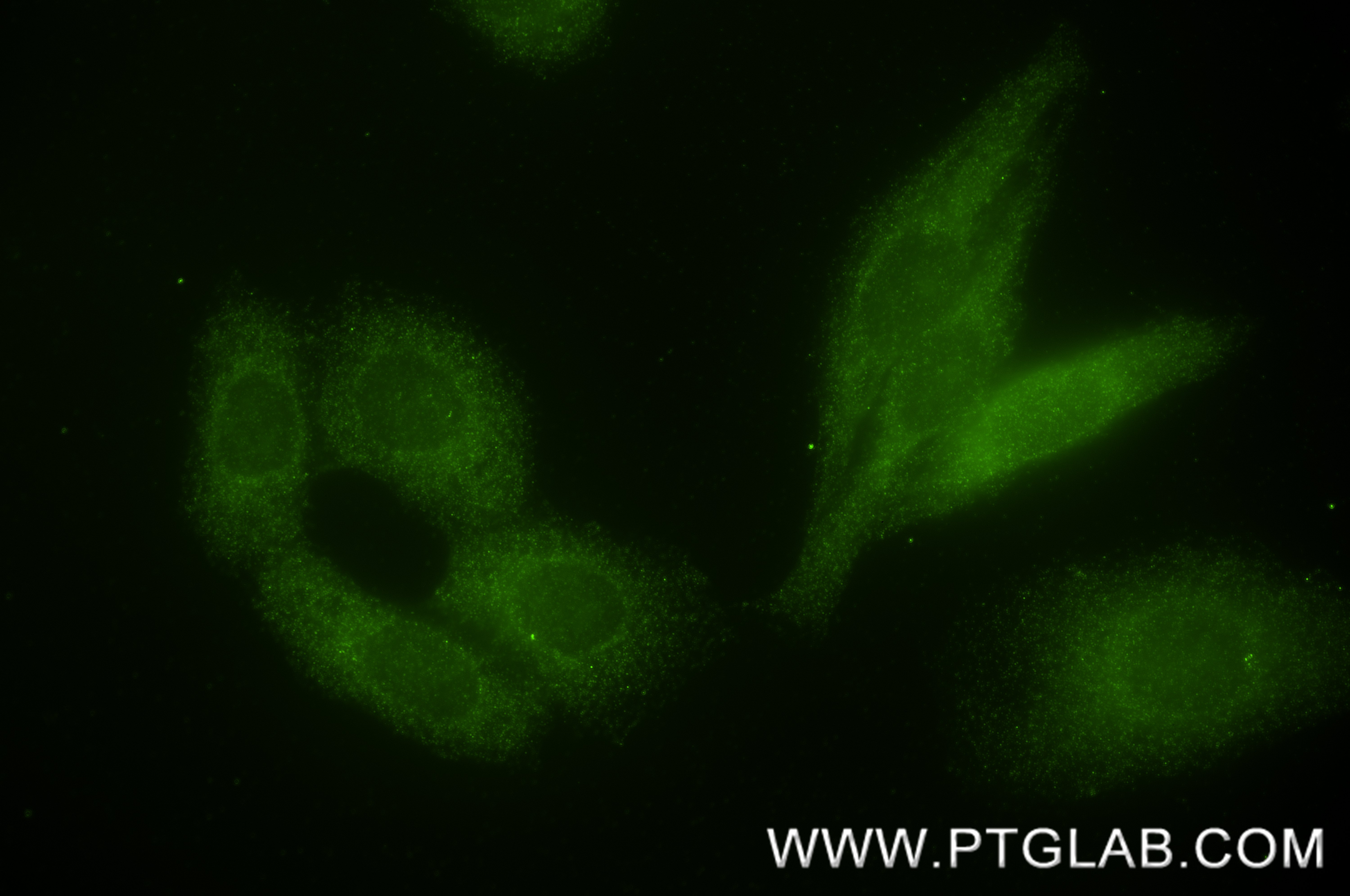 IF Staining of HepG2 using 87033-3-RR (same clone as 87033-3-PBS) IF Staining of HepG2 using 87033-3-RR (same clone as 87033-3-PBS)