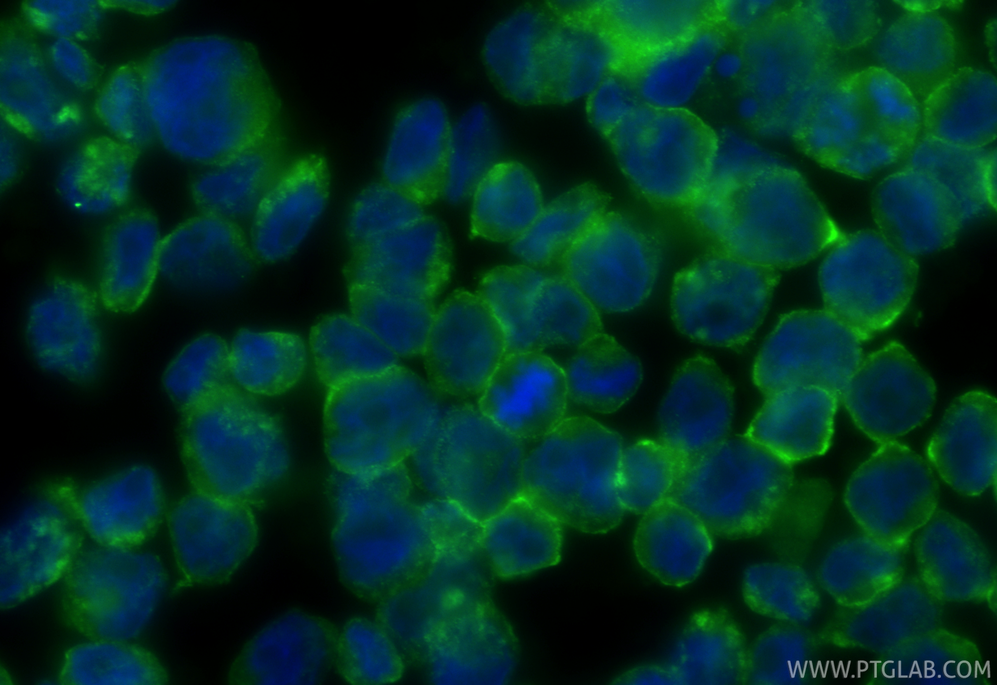 IF Staining of HL-60 using 21286-1-AP