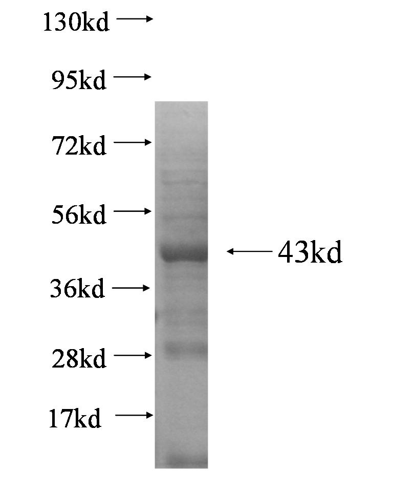 MORC1 fusion protein Ag5396 SDS-PAGE MORC1 fusion protein Ag5396 SDS-PAGE