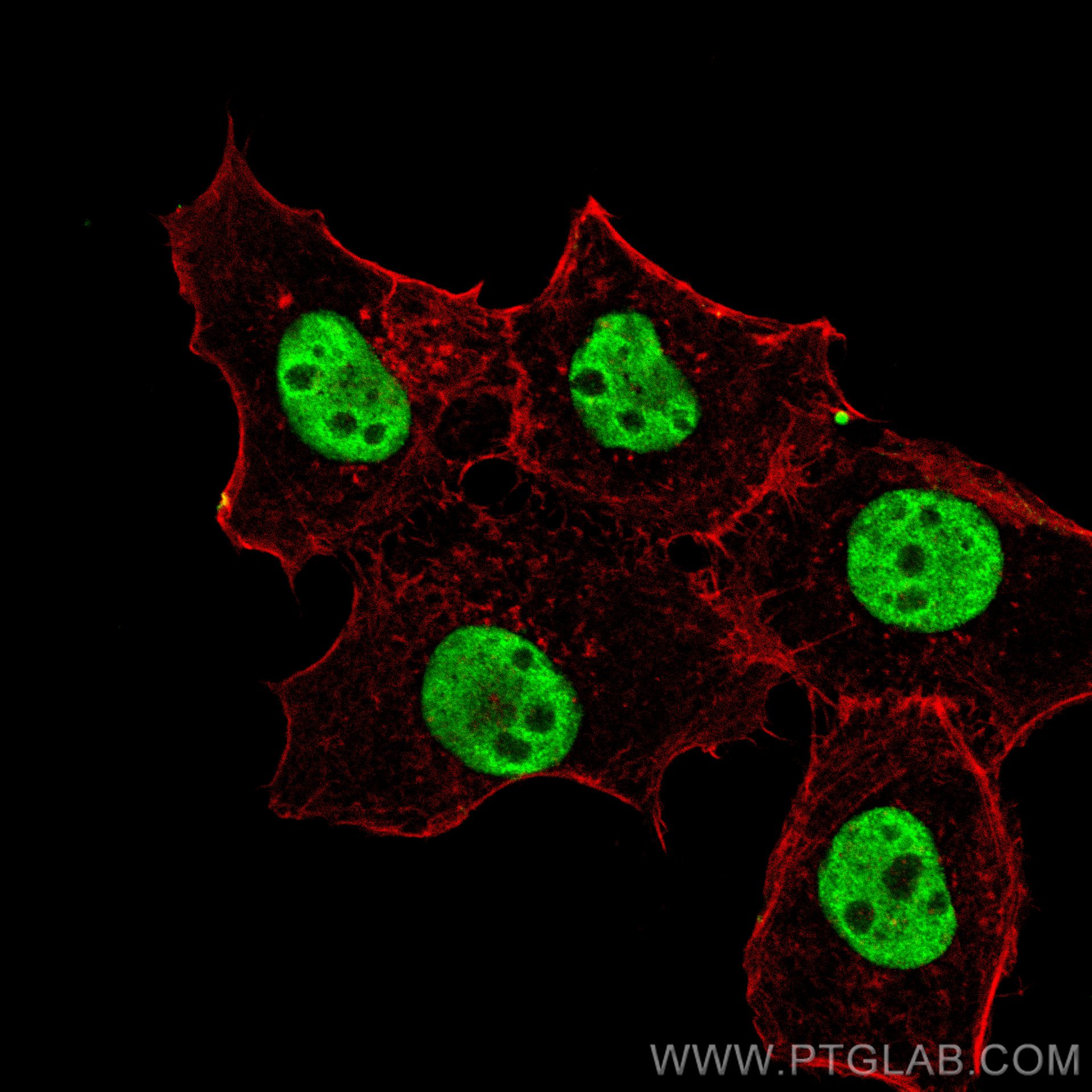 IF Staining of A431 using 24994-1-AP