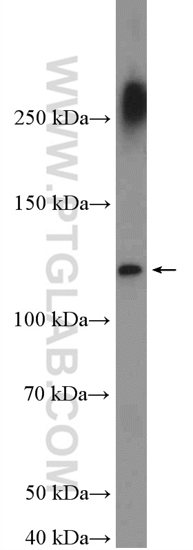 WB analysis of HeLa using 24994-1-AP
