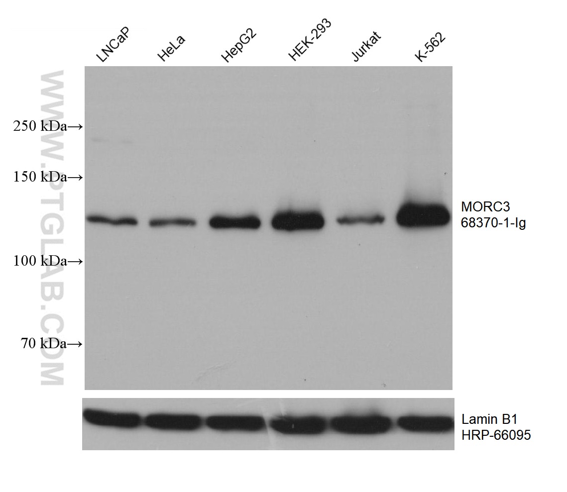 WB analysis using 68370-1-Ig