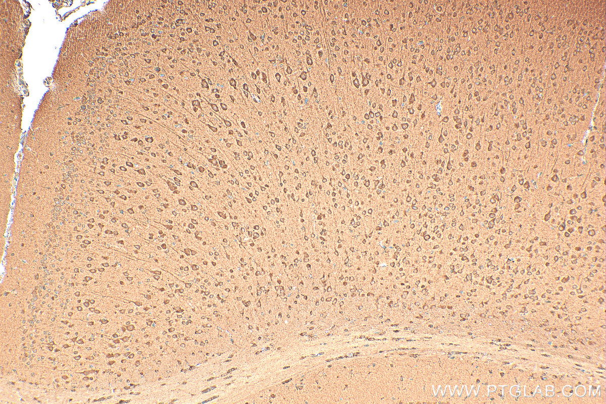 IHC staining of mouse brain using 27244-1-AP