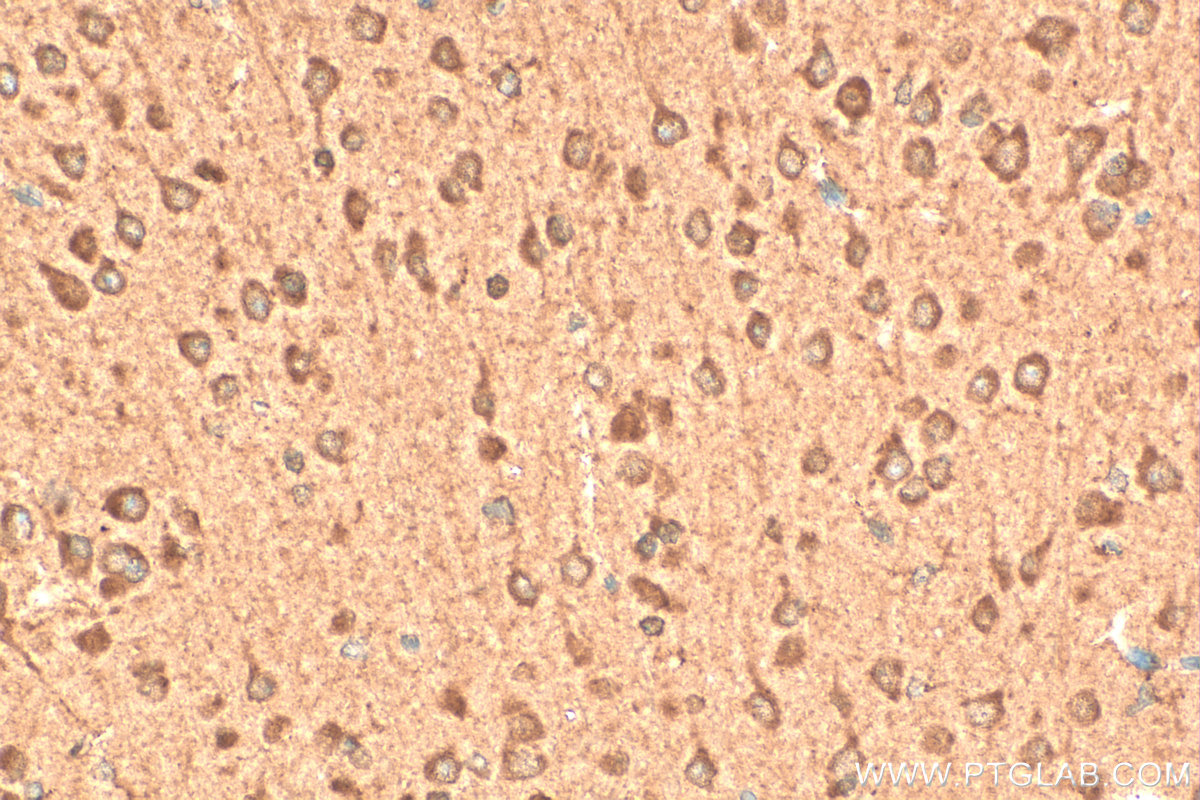 IHC staining of mouse brain using 27244-1-AP