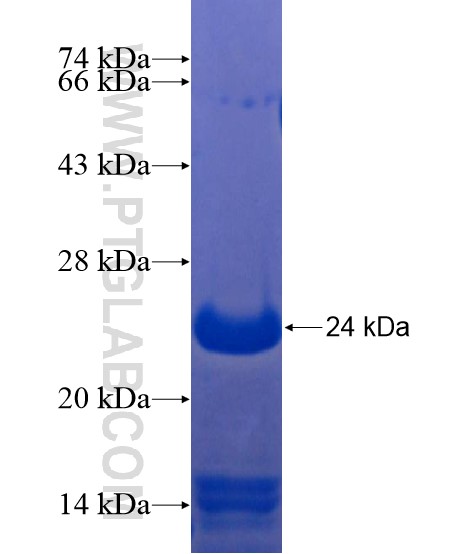 MORN5 fusion protein Ag21691 SDS-PAGE