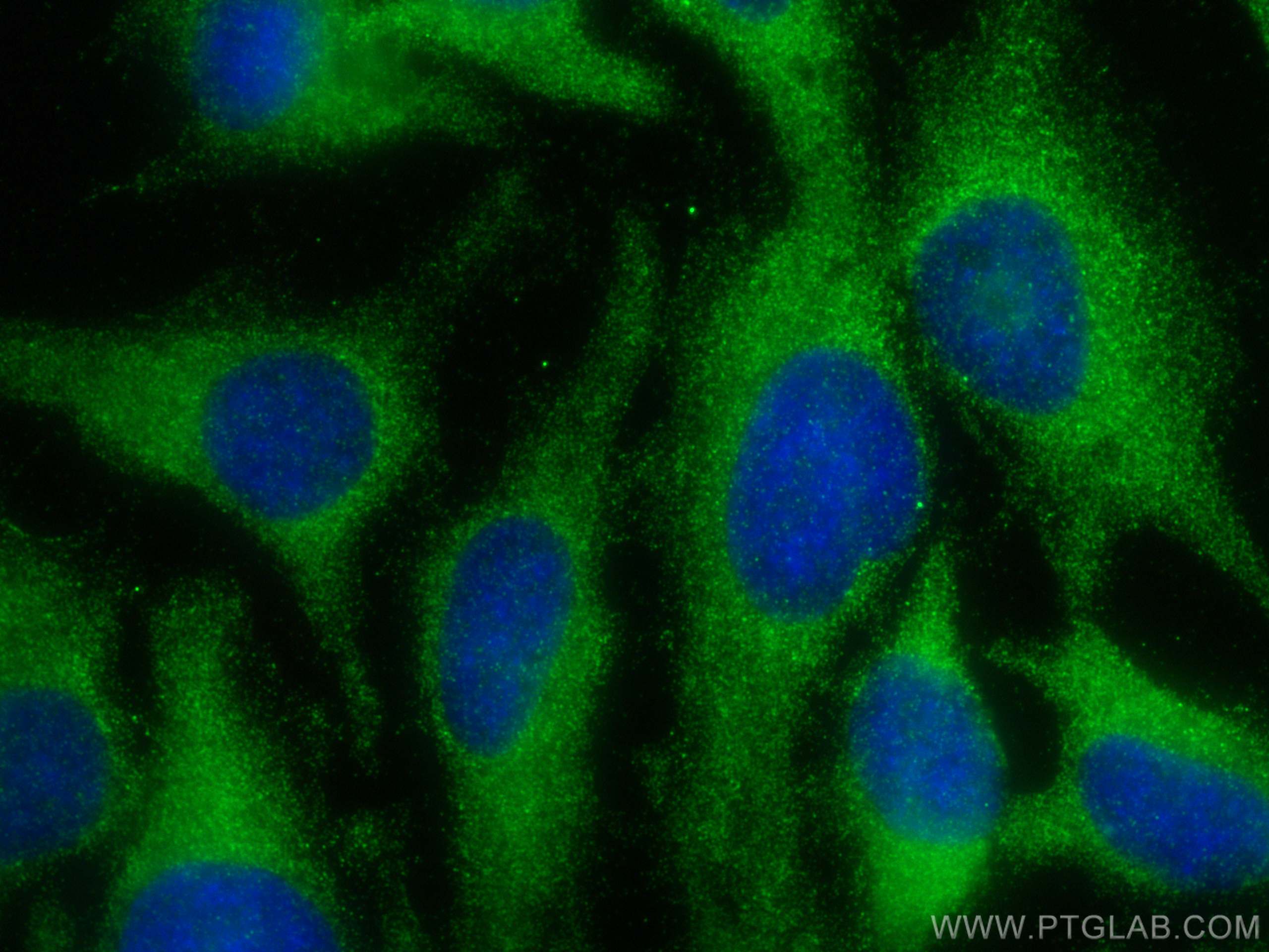 IF Staining of HeLa using 26454-1-AP