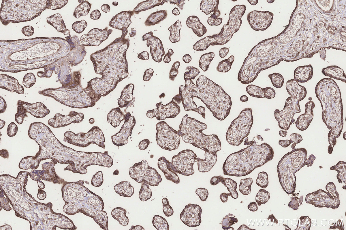 IHC staining of human placenta using 25490-1-AP IHC staining of human placenta using 25490-1-AP