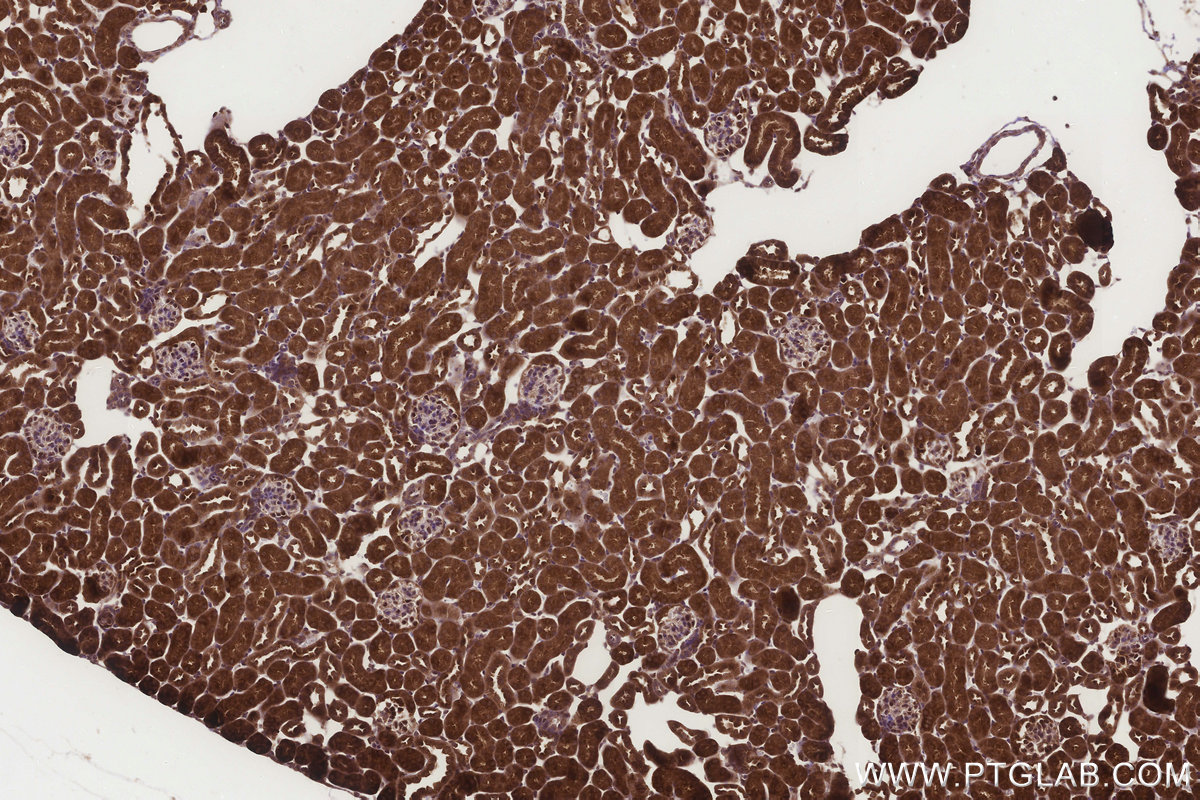 IHC staining of mouse kidney using 25490-1-AP IHC staining of mouse kidney using 25490-1-AP