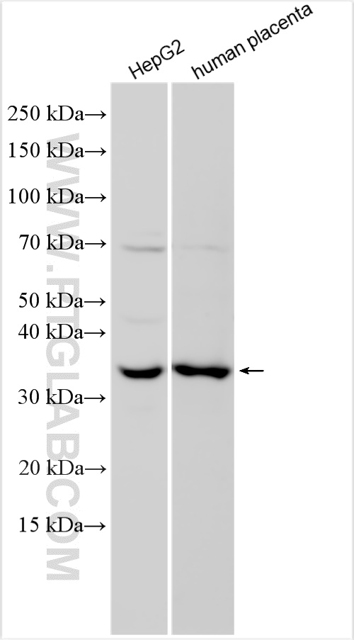 WB analysis using 25490-1-AP