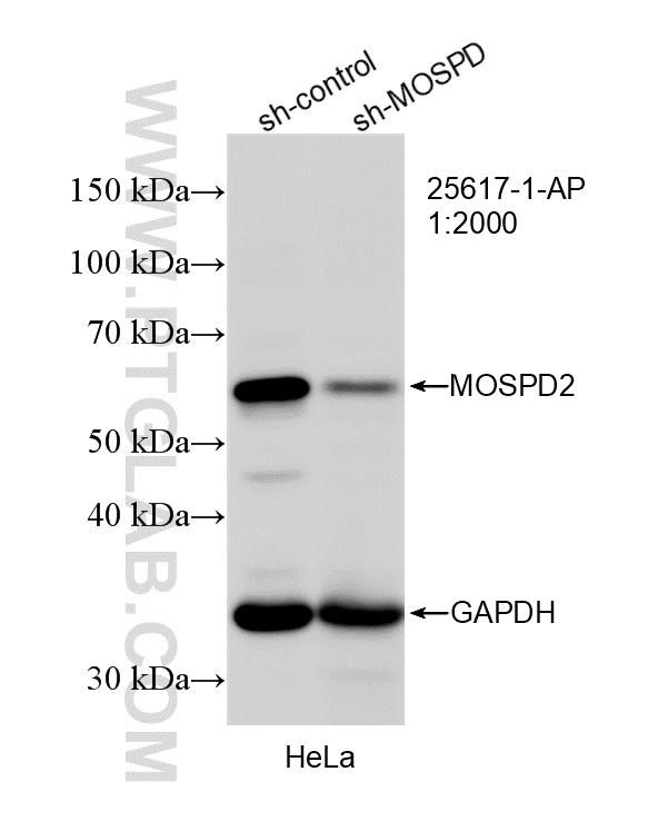WB analysis of HeLa using 25617-1-AP (same clone as 25617-1-PBS) WB analysis of HeLa using 25617-1-AP (same clone as 25617-1-PBS)