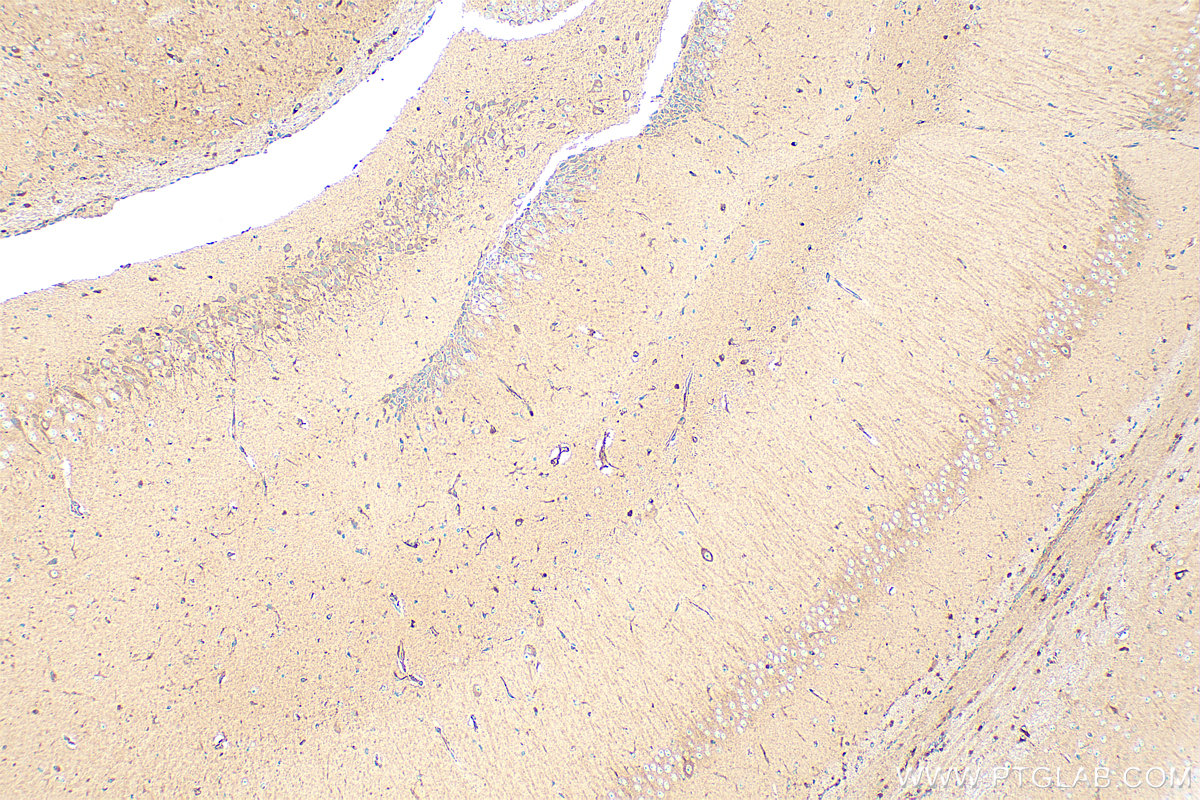 IHC staining of mouse brain using 83398-1-RR (same clone as 83398-1-PBS)