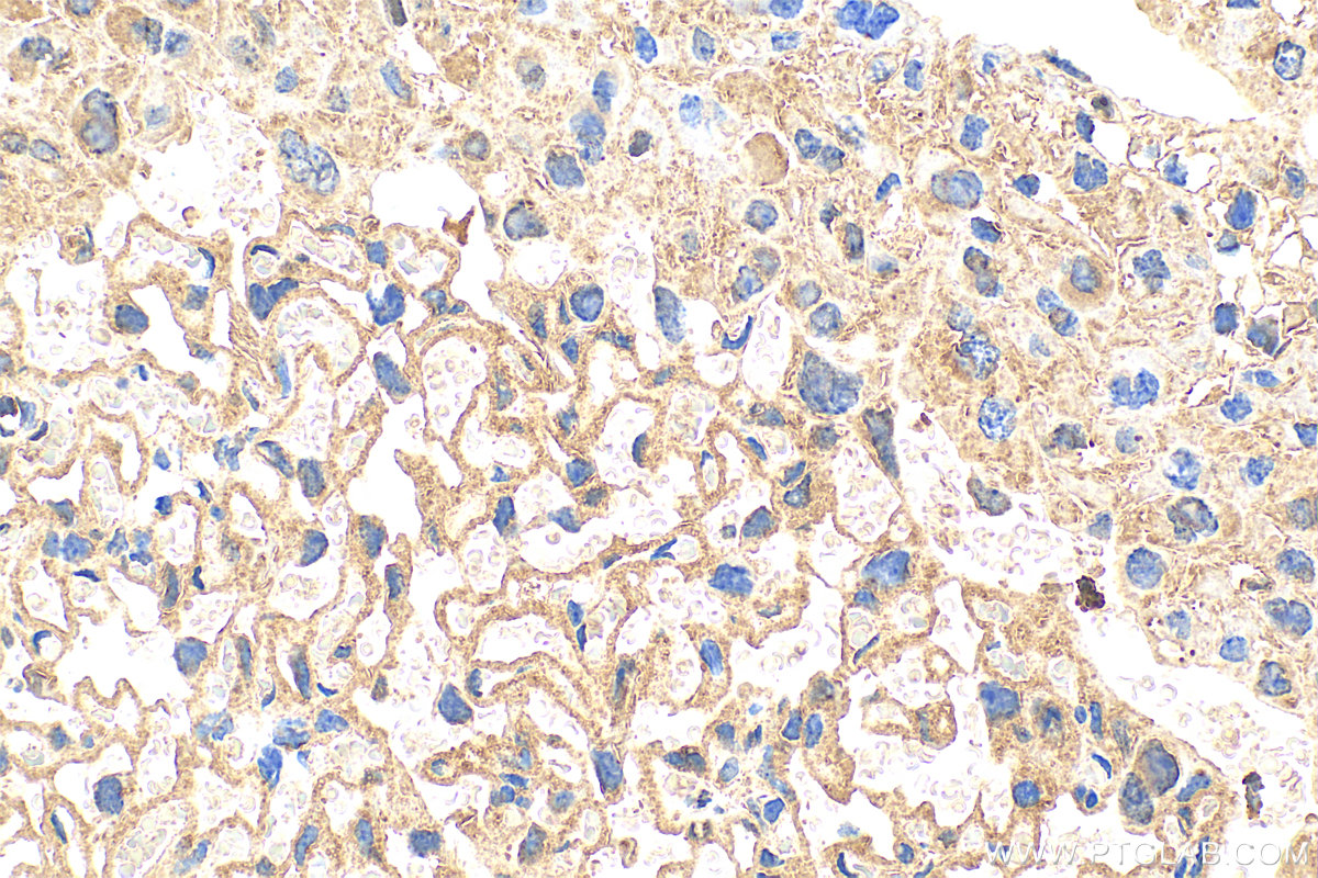 IHC staining of mouse placenta using 83398-1-RR (same clone as 83398-1-PBS)