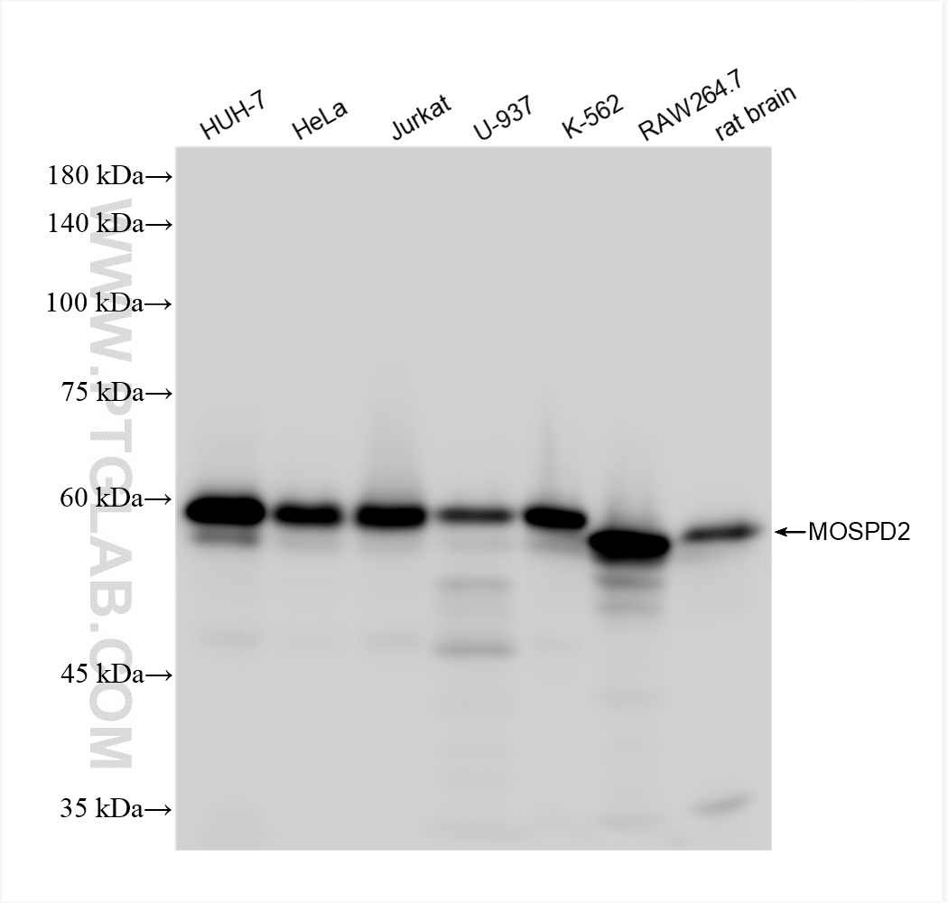 WB analysis using 83398-1-RR (same clone as 83398-1-PBS)