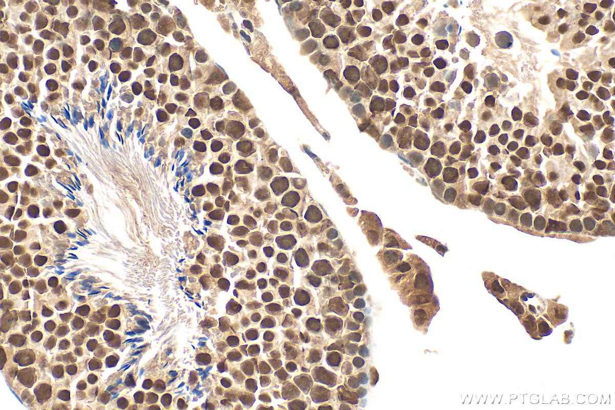 IHC staining of mouse testis using 26168-1-AP
