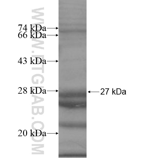 MOSPD3 fusion protein Ag15421 SDS-PAGE MOSPD3 fusion protein Ag15421 SDS-PAGE