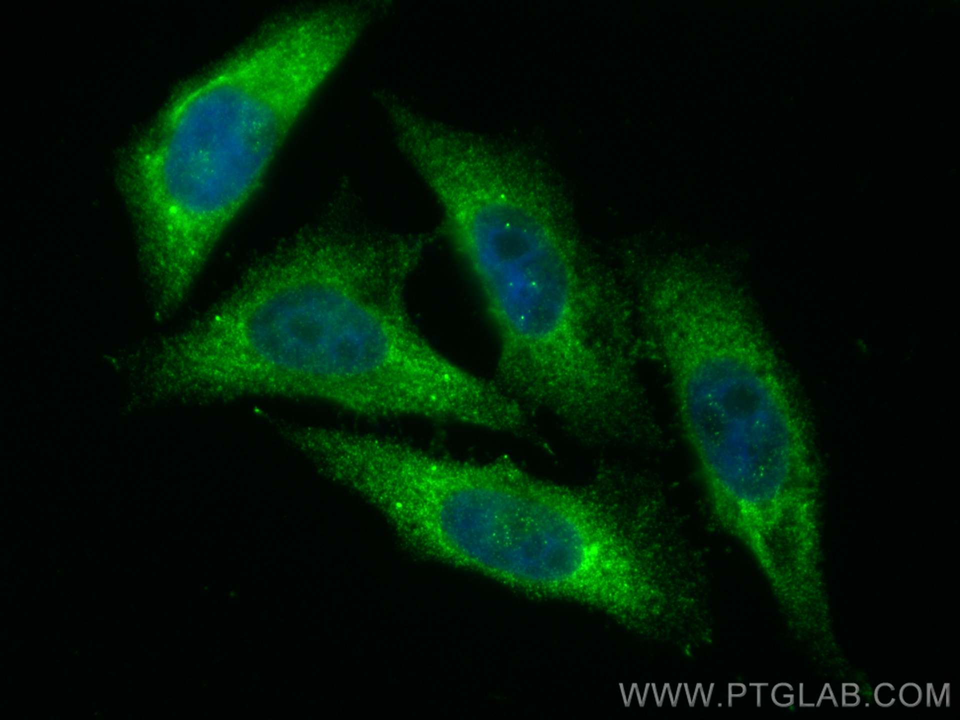 IF Staining of HepG2 using 10370-1-AP (same clone as 10370-1-PBS)
