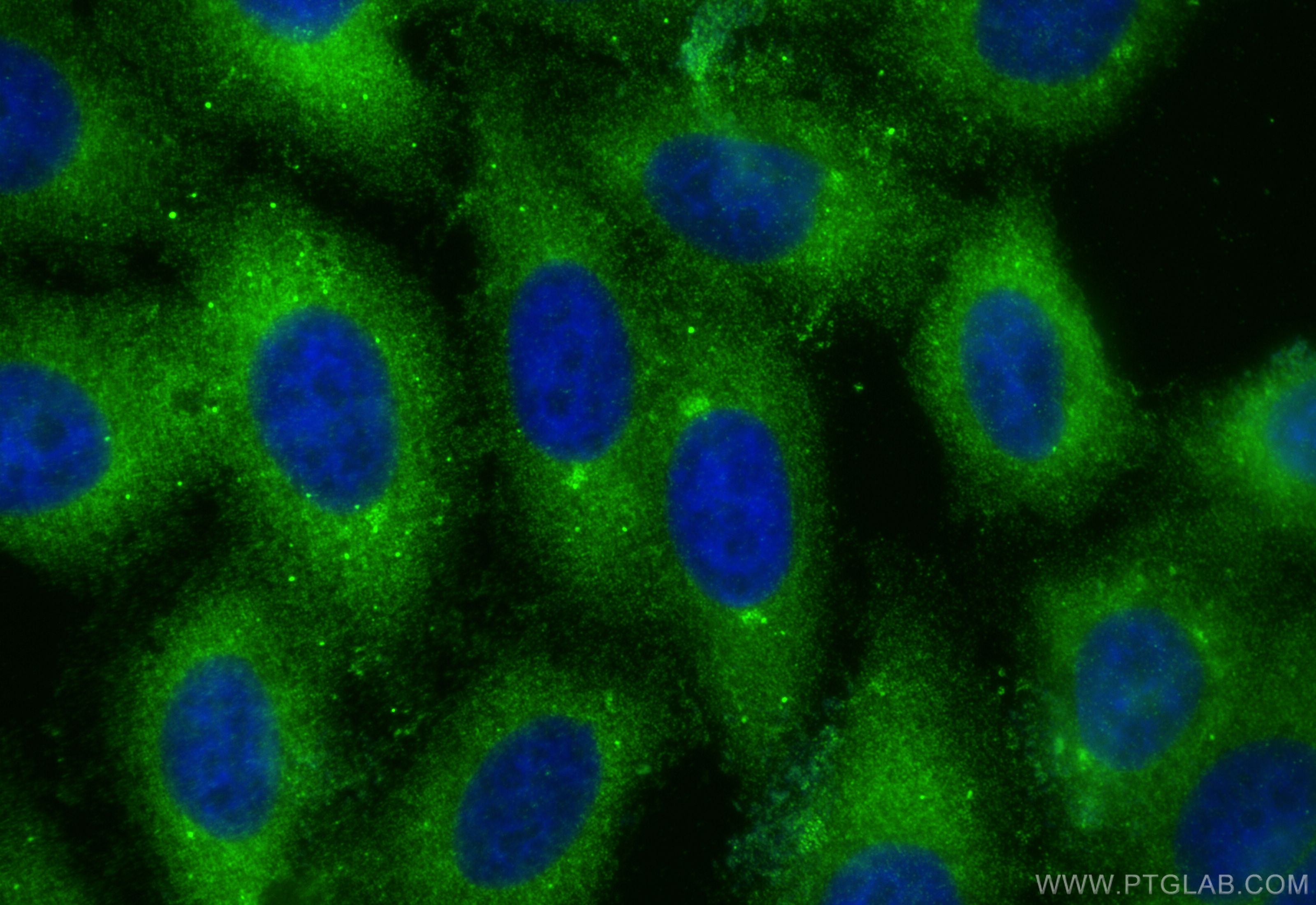 IF Staining of HepG2 using 10370-1-AP