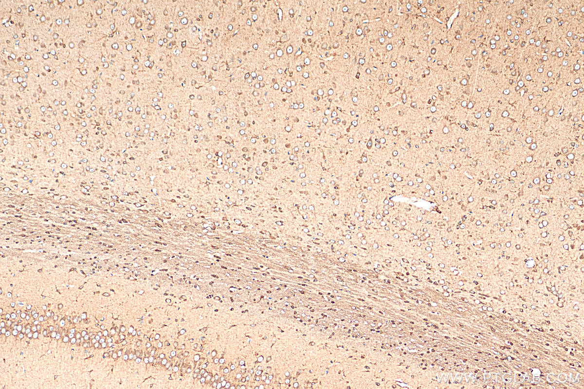 IHC staining of rat brain using 11545-1-AP