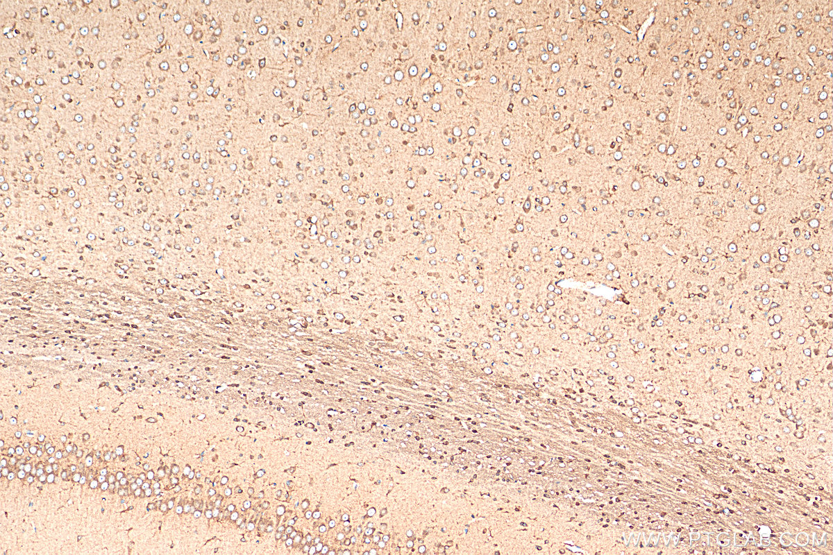 IHC staining of rat brain using 11545-1-AP