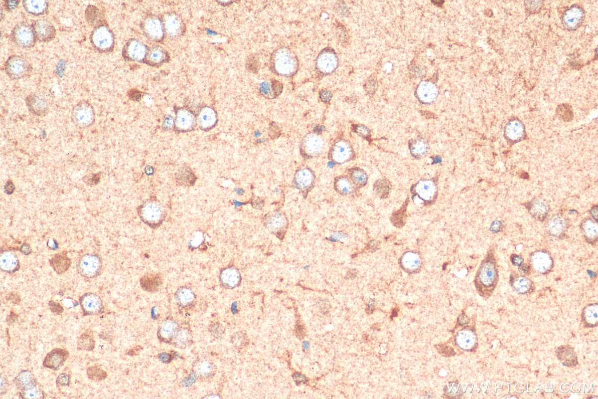 IHC staining of rat brain using 11545-1-AP