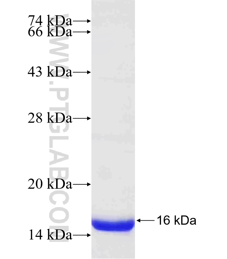 MOXD1 fusion protein Ag30330 SDS-PAGE MOXD1 fusion protein Ag30330 SDS-PAGE
