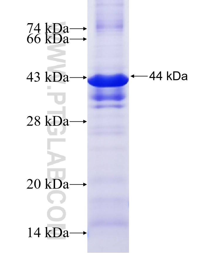 MOXD1 fusion protein Ag19203 SDS-PAGE MOXD1 fusion protein Ag19203 SDS-PAGE