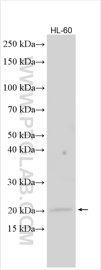 WB analysis using 30868-1-AP