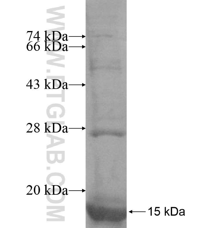 MPDU1 fusion protein Ag16944 SDS-PAGE MPDU1 fusion protein Ag16944 SDS-PAGE
