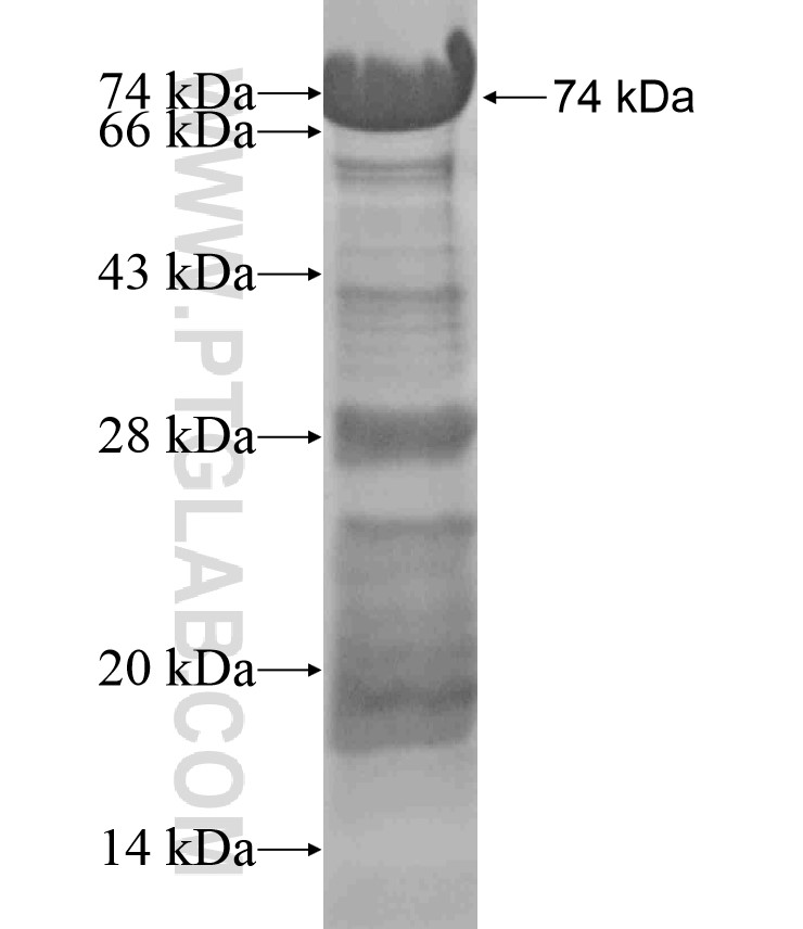 MUPP1 fusion protein Ag18222 SDS-PAGE MUPP1 fusion protein Ag18222 SDS-PAGE