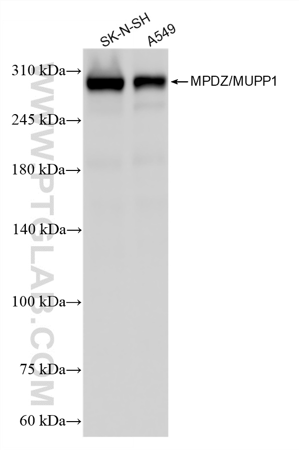 WB analysis using 87358-1-RR (same clone as 87358-1-PBS)