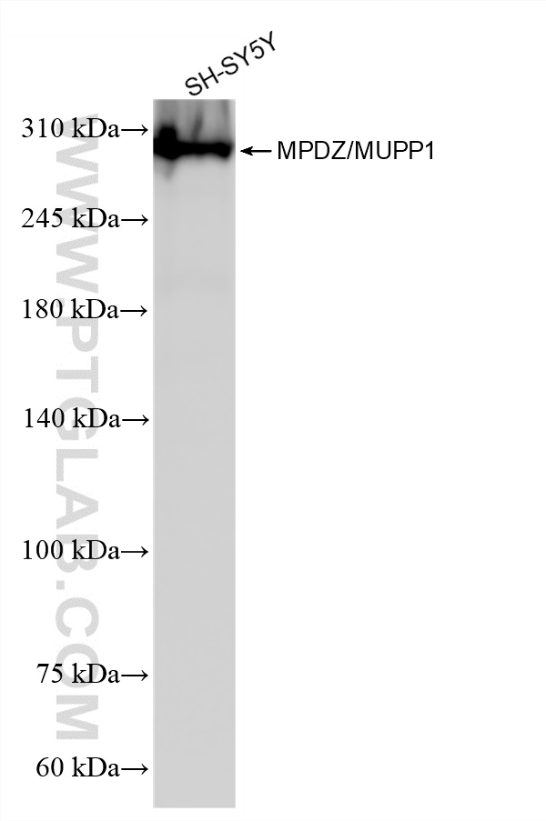 WB analysis of SH-SY5Y using 87358-1-RR (same clone as 87358-1-PBS)