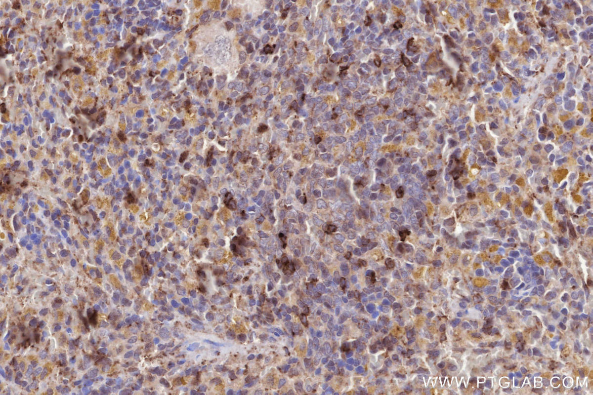 IHC staining of rat spleen using 23960-1-AP IHC staining of rat spleen using 23960-1-AP