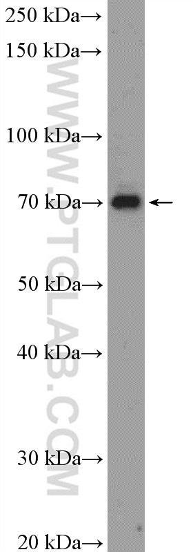 MPEG1