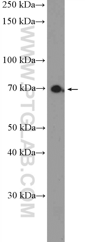 WB analysis of HeLa using 23960-1-AP