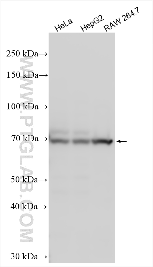 WB analysis using 23960-1-AP WB analysis using 23960-1-AP