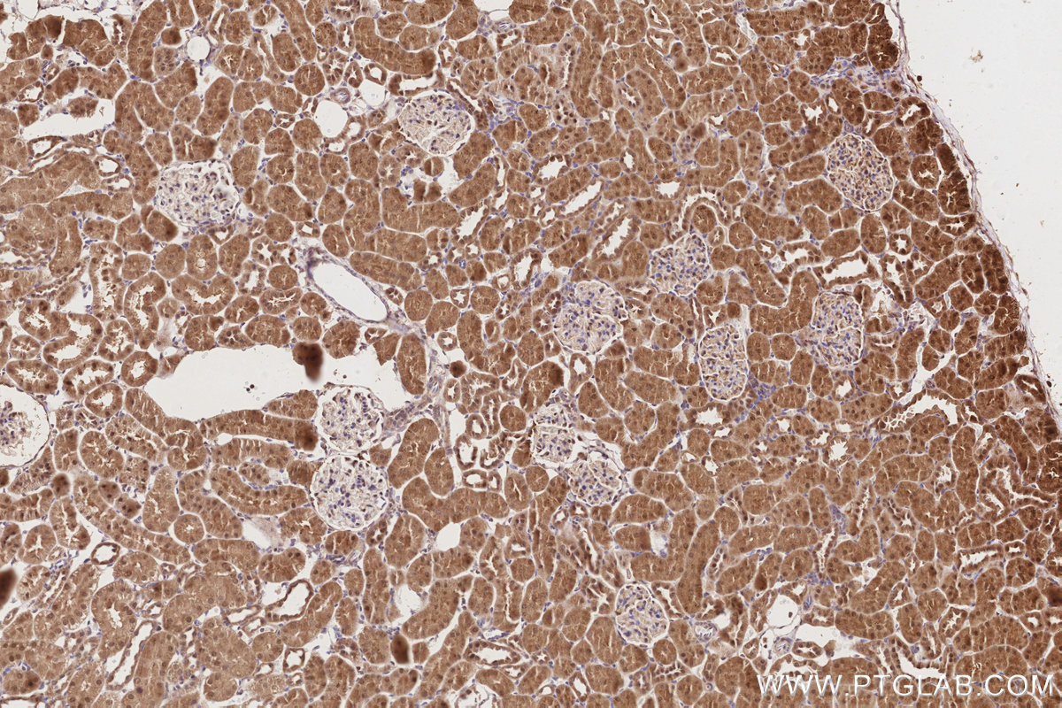 IHC staining of rat kidney using 10695-1-AP IHC staining of rat kidney using 10695-1-AP