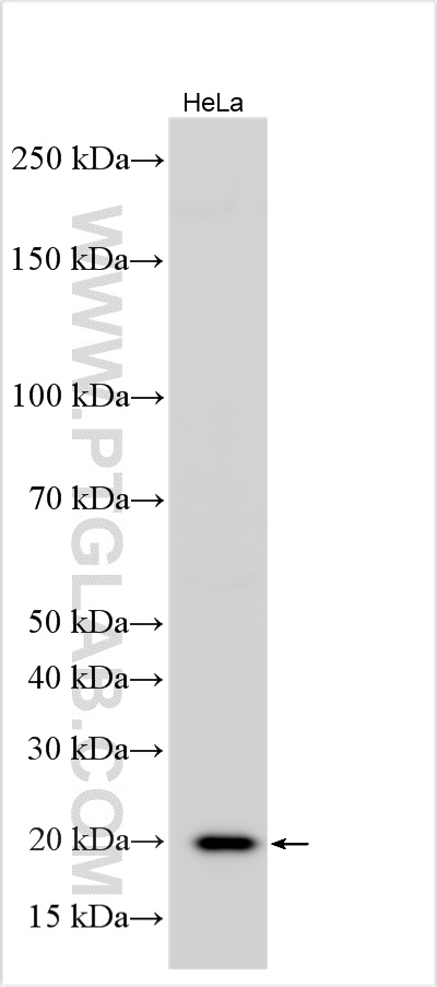 WB analysis using 10695-1-AP (same clone as 10695-1-PBS) WB analysis using 10695-1-AP (same clone as 10695-1-PBS)