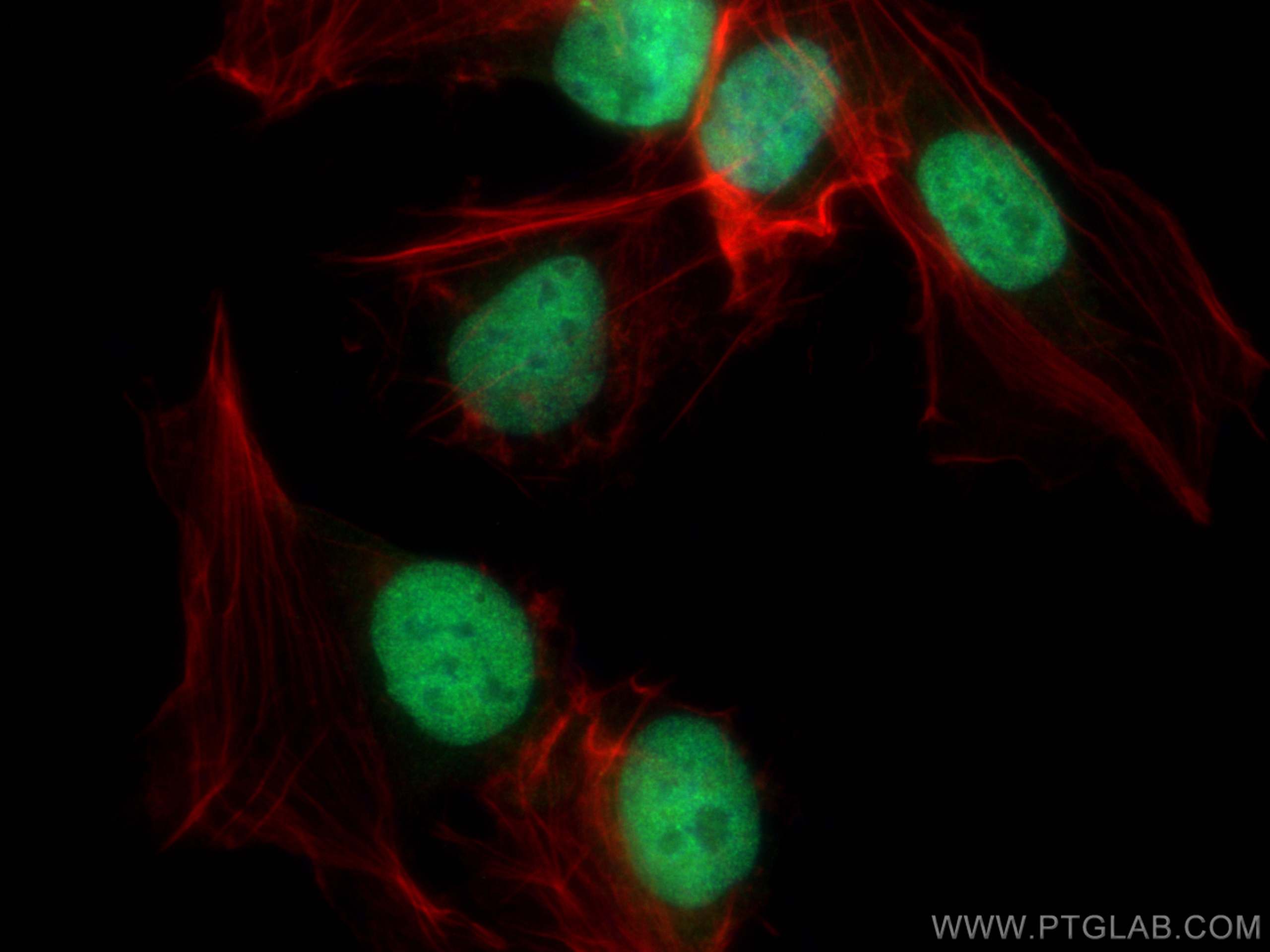 IF Staining of U2OS using 16796-1-AP