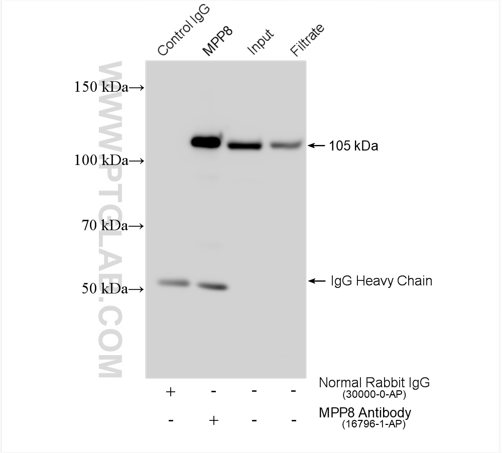 IP experiment of HEK-293 using 16796-1-AP