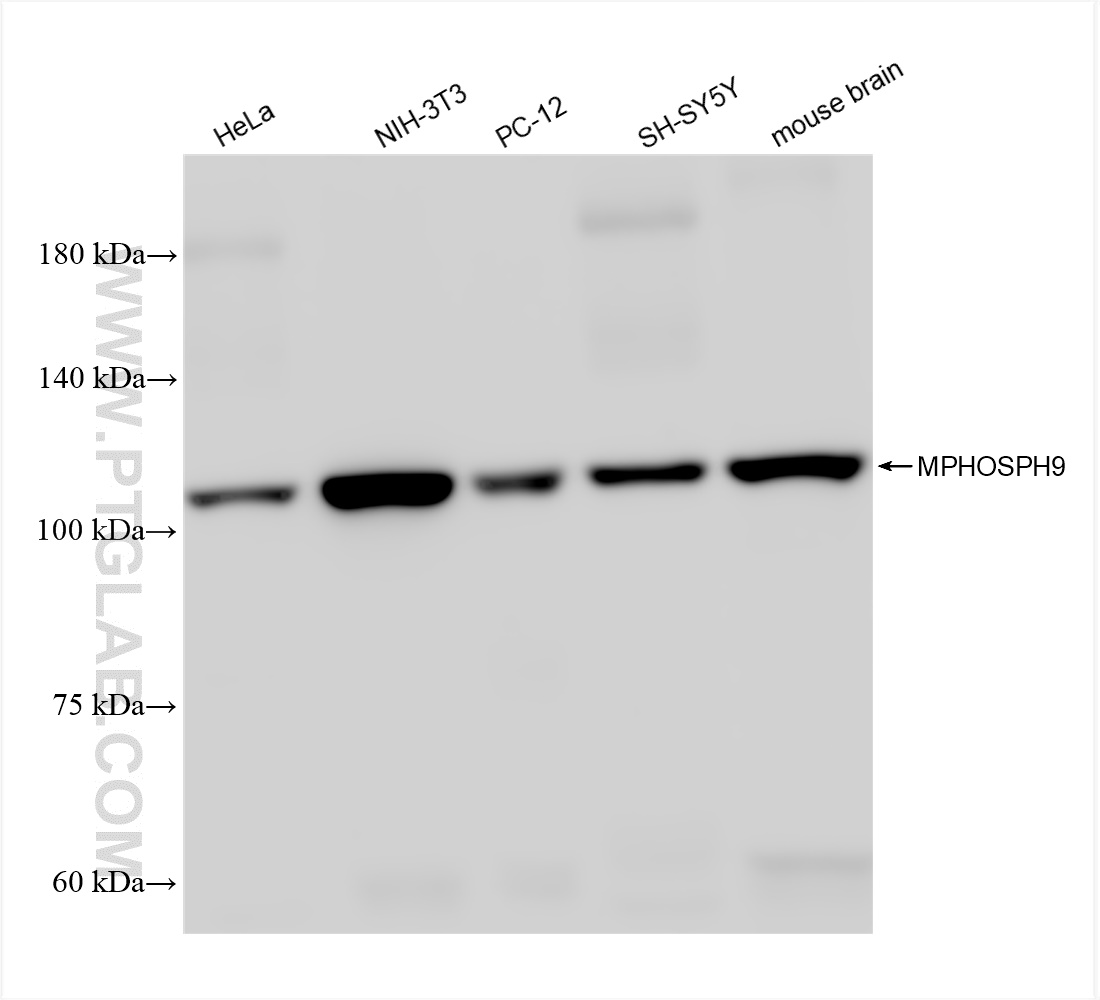 WB analysis using 83397-5-RR