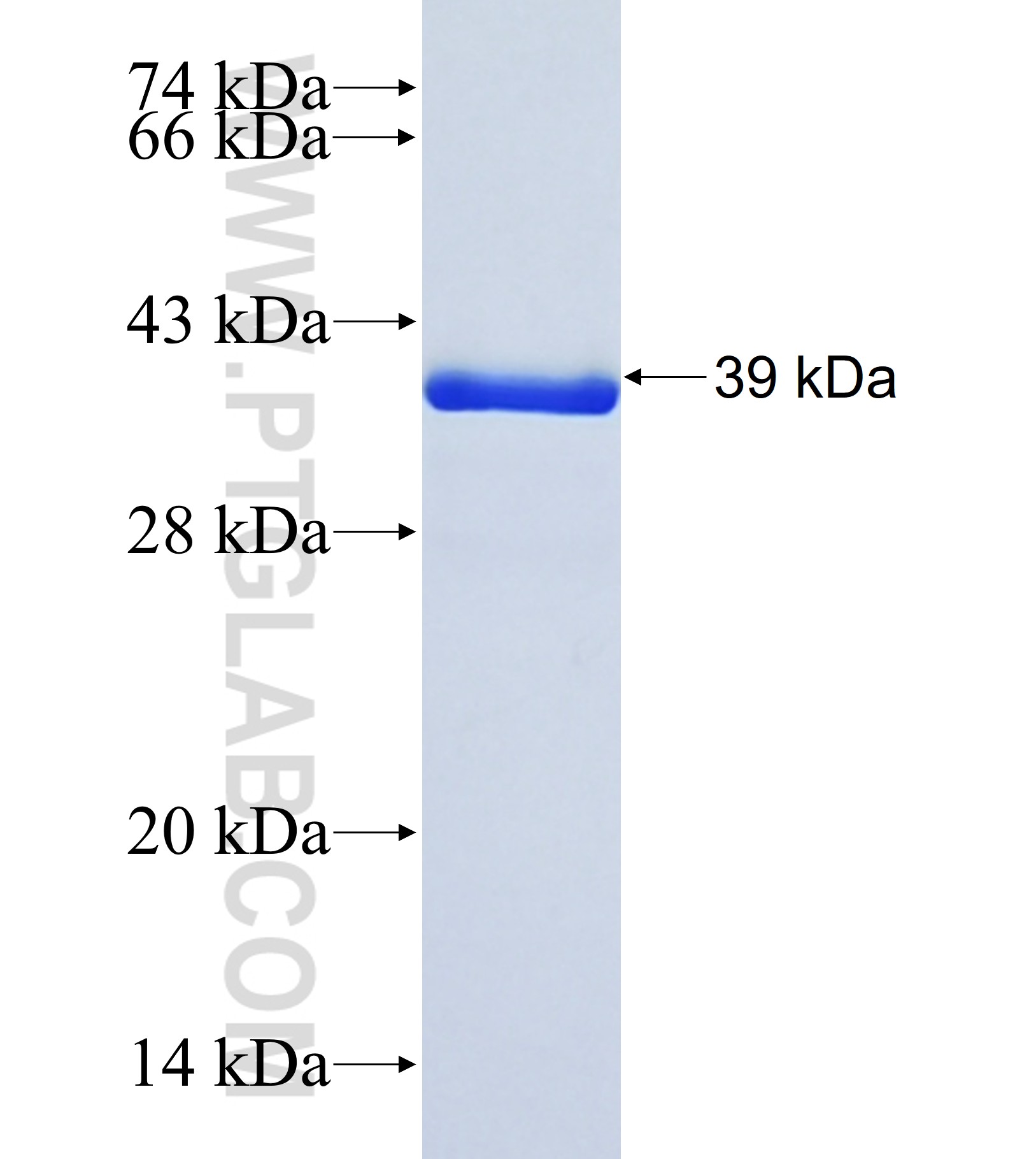 MPHOSPH9 fusion protein Ag41968 SDS-PAGE MPHOSPH9 fusion protein Ag41968 SDS-PAGE