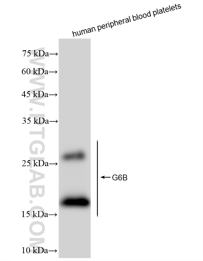 WB analysis using 88167-2-RR (same clone as 88167-2-PBS)