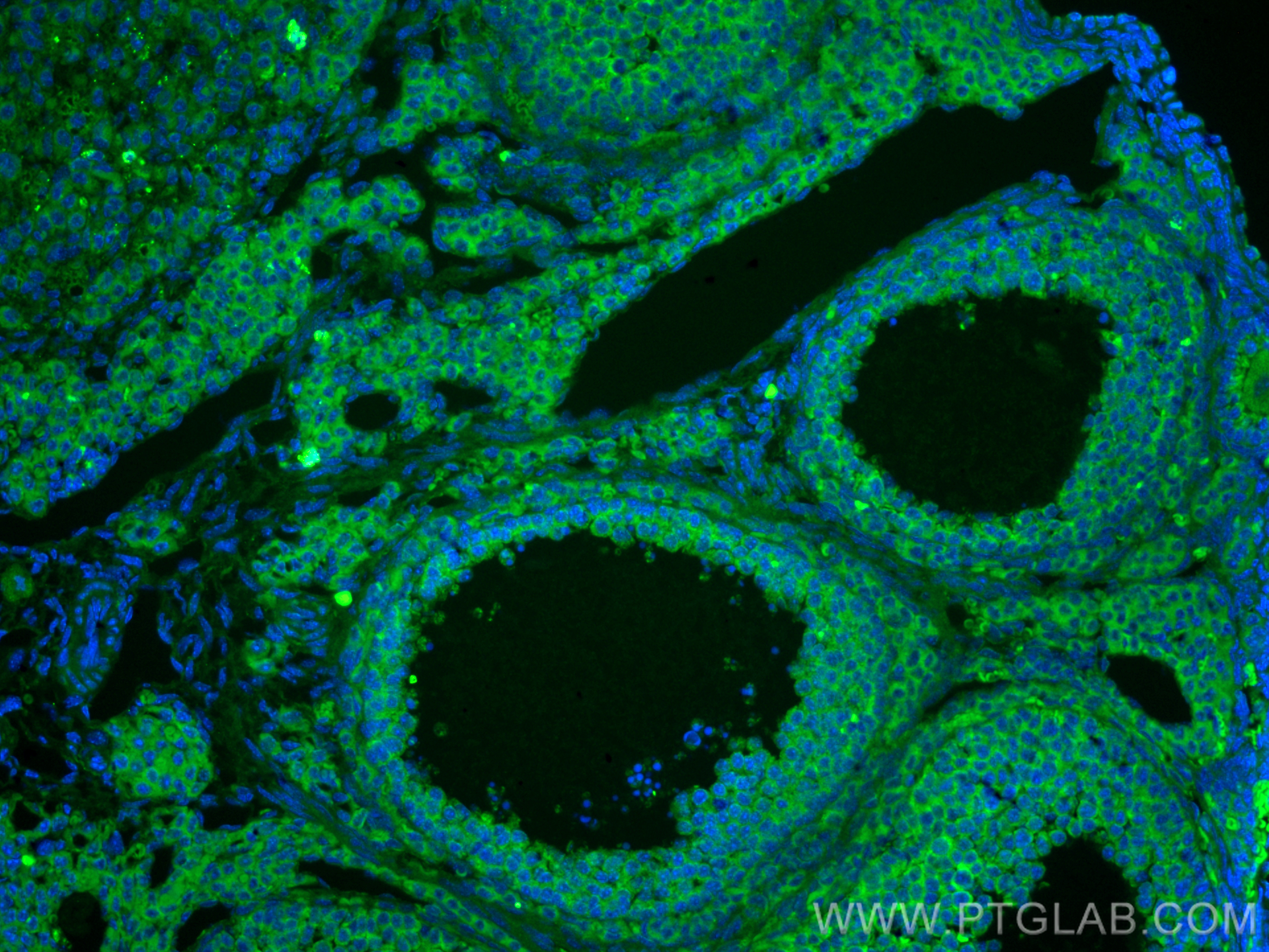 IF Staining of mouse ovary using 22225-1-AP