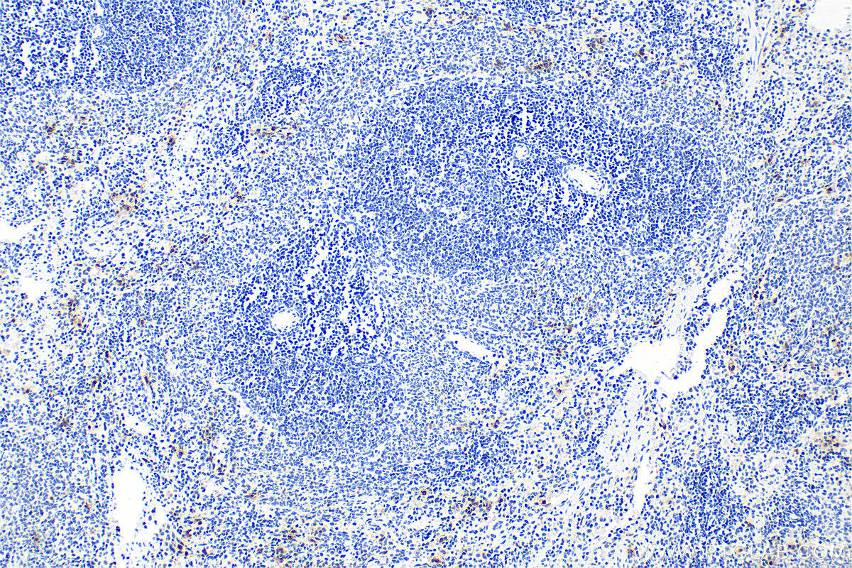 IHC staining of rat spleen using 22225-1-AP