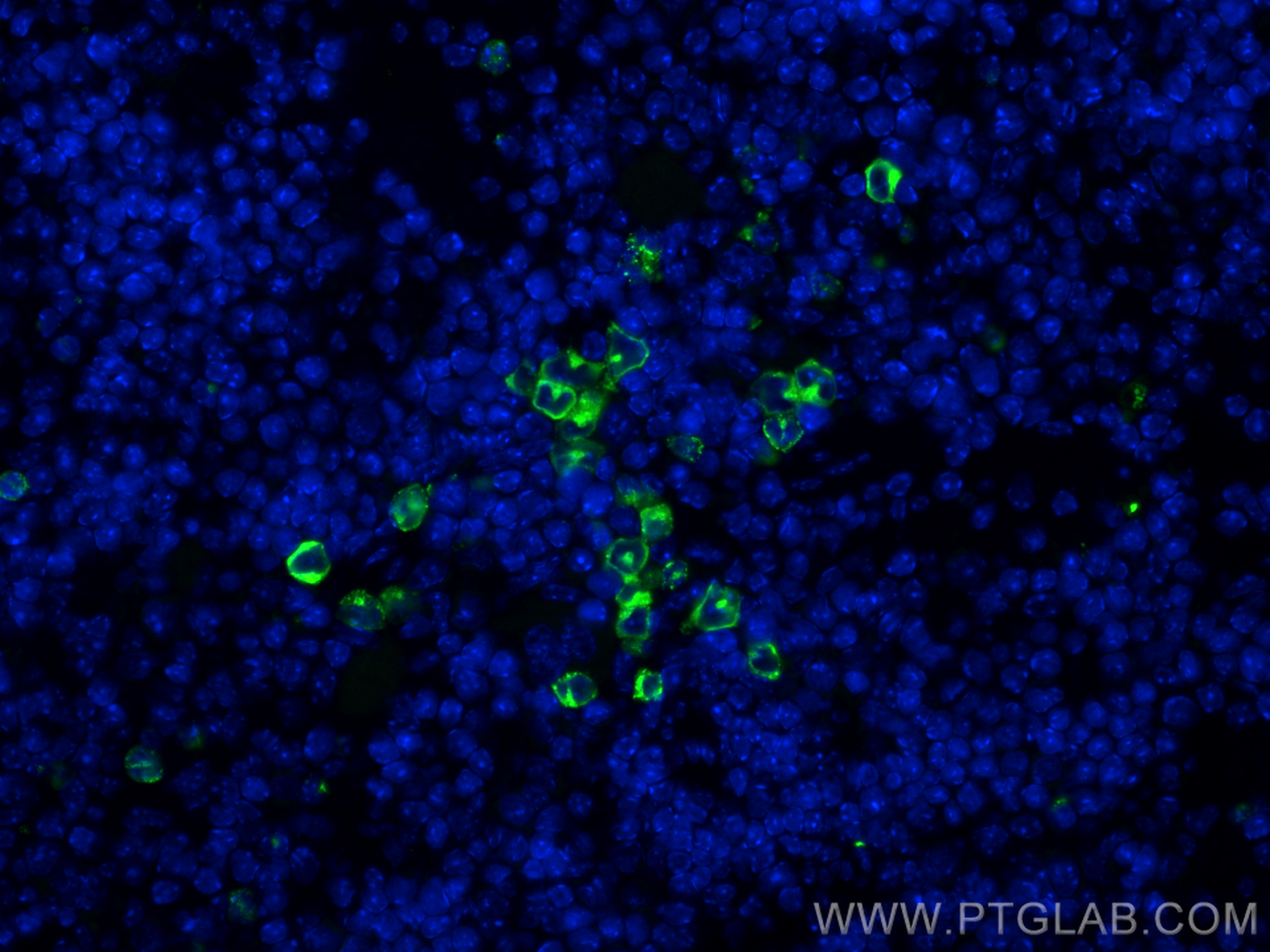 IF Staining of mouse spleen using 32385-1-AP