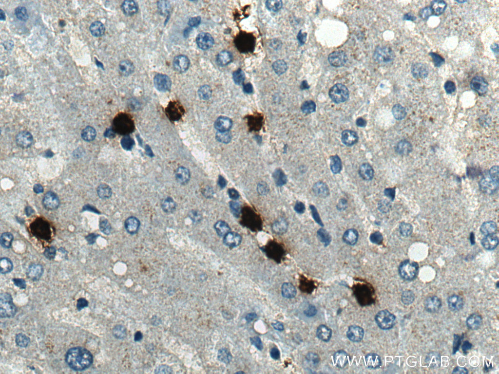 IHC staining of human liver using 66177-1-Ig