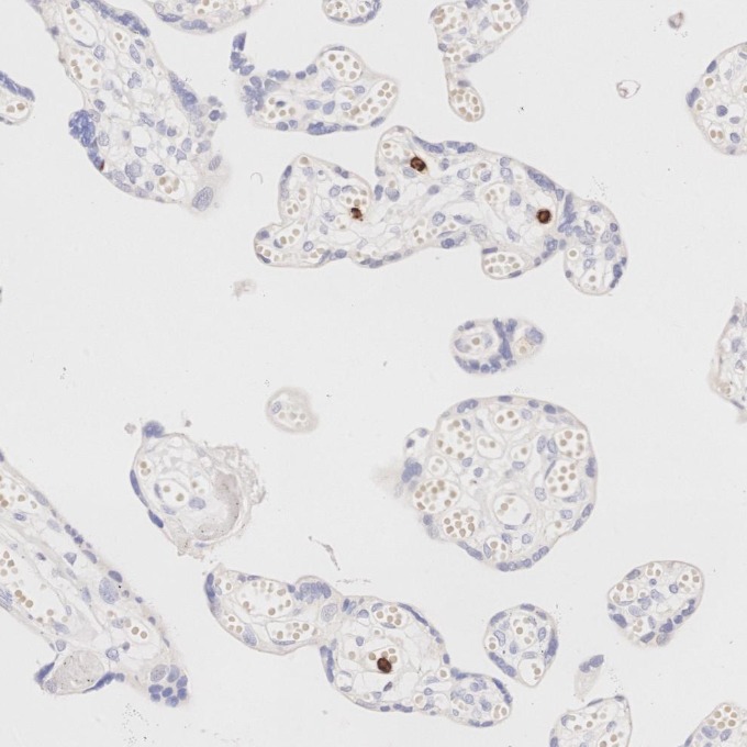 IHC staining of human placenta using 81610-1-RR