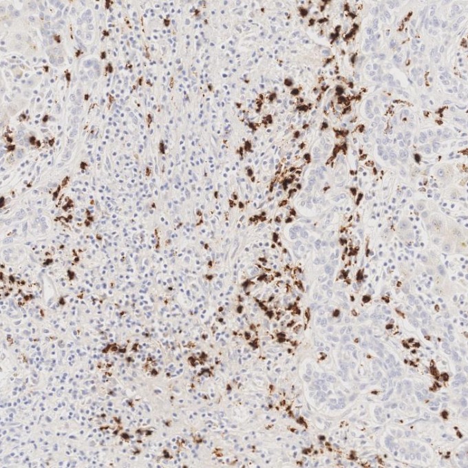 IHC staining of human liver using 81610-1-RR