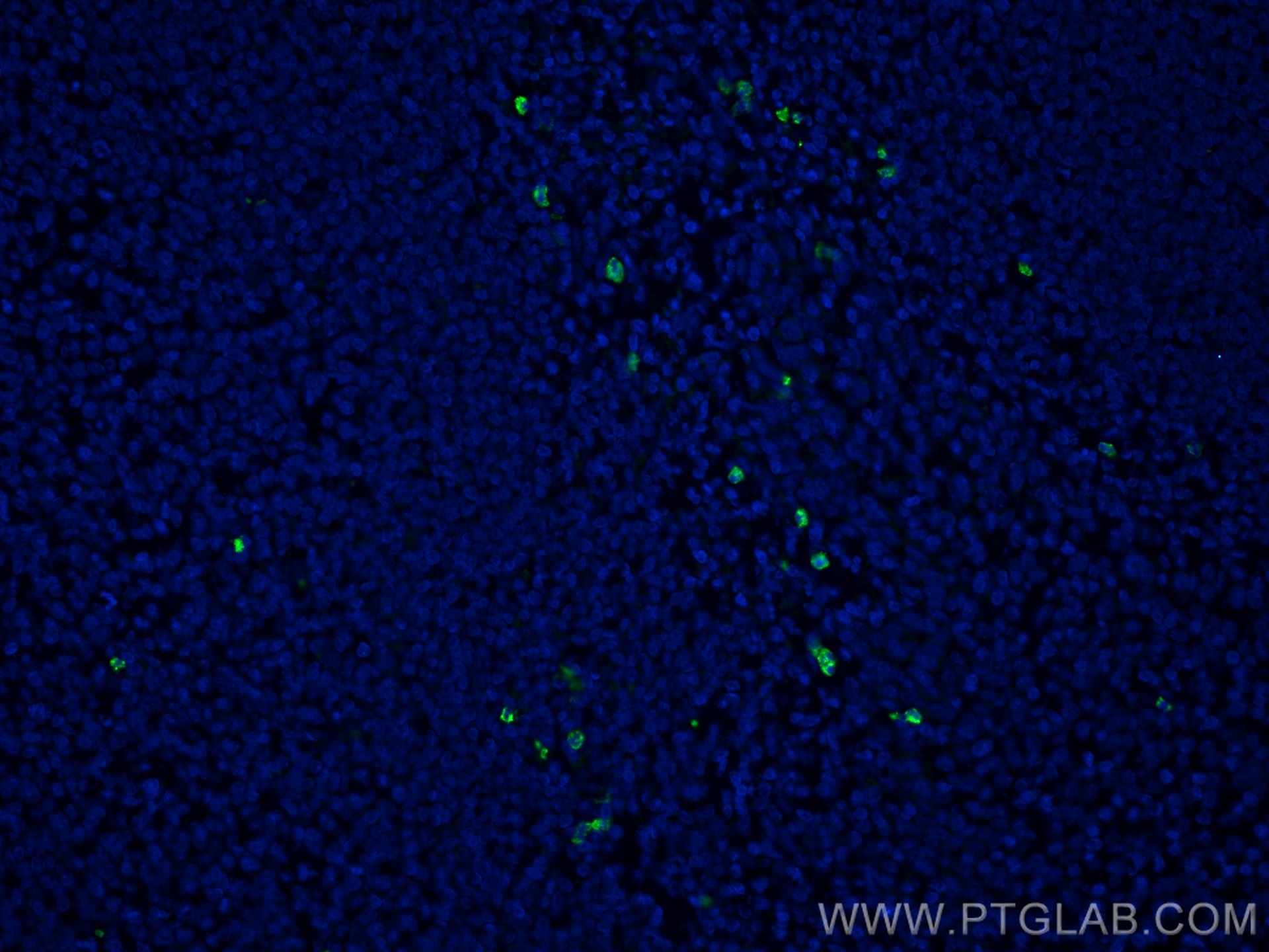 IF Staining of human tonsillitis using CL488-66177